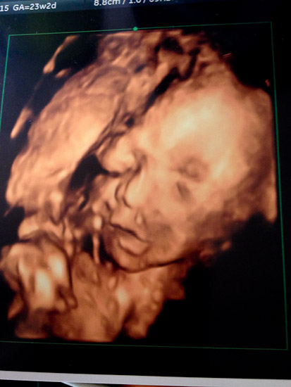 19 week 4d ultrasound pictures