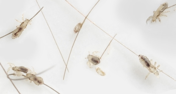 What Do Lice Look Like? - New Kids Center